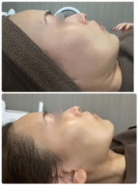 画像1306